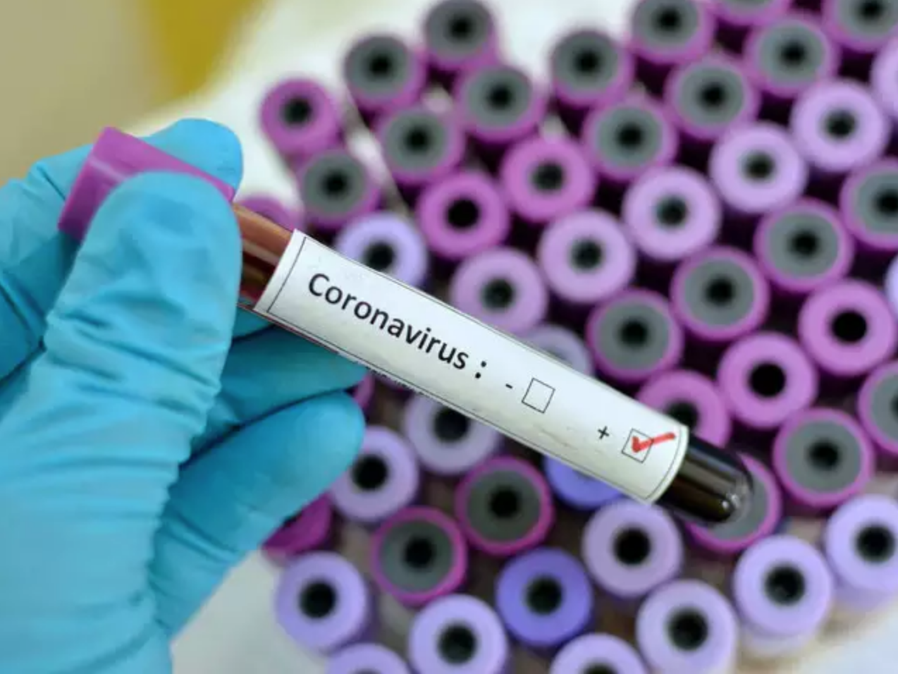 Koronavirüs (Coronavirüs) Nedir? Belirtileri Nelerdir? Gizemlidunyalar.net